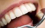 کدام خدمات دندانپزشکی در تعهدات پرداخت بیمه سلامت است؟