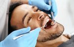 آیا کامپوزیت باعث پوسیدگی دندان میشود؟ | یکی از سوالاتی