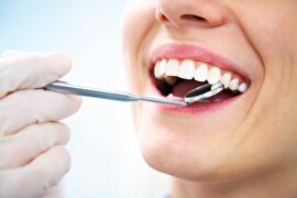 پژوهشگر ژاپنی و دارویی برای رشد دوباره دندان ها در انسان!